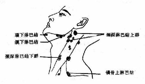 往年11月30日淋巴水肿热门疗法详解与评测报告